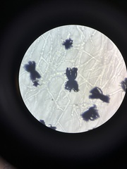 Aspergillus