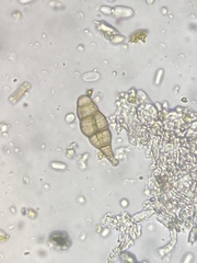 Erysiphe liriodendri