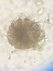 Erysiphe liriodendri