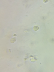 Hygrocybe laeta var. laeta image