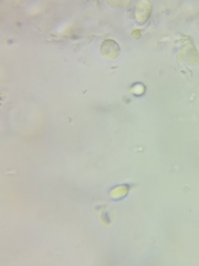 Hygrocybe laeta var. laeta image