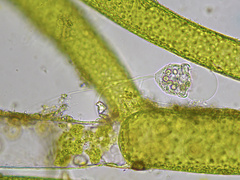 Vorticella