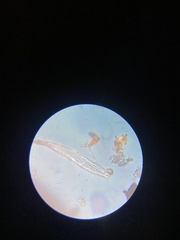 Cymbella
