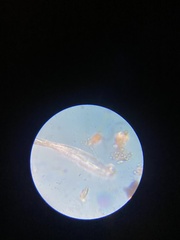 Cymbella
