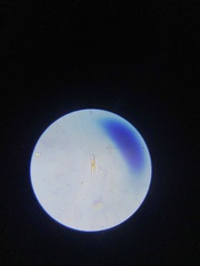 Cymbella