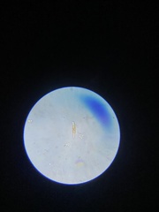 Cymbella
