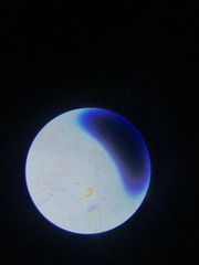 Cocconeis