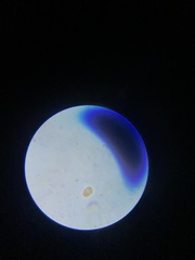 Cocconeis