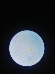 Cocconeis