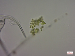 Coelastrum