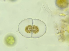 Cosmarium pyramidatum