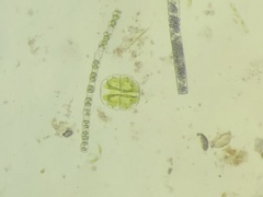 Micrasterias truncata