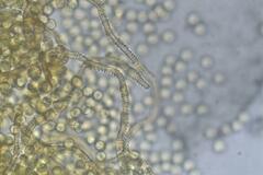 Arcyria obvelata