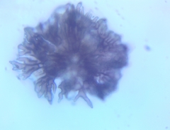 Rosellinia corticium