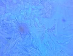 Dacrymyces minor