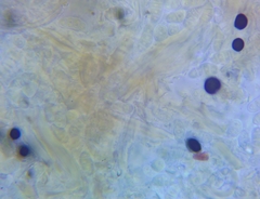Dacrymyces minor