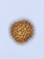 Fossombronia wondraczekii