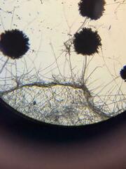Aspergillus