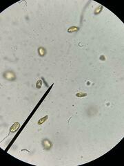 Heterosigma akashiwo