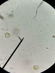 Heterosigma akashiwo