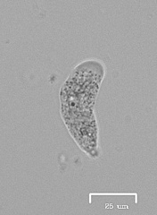 Amoebidae