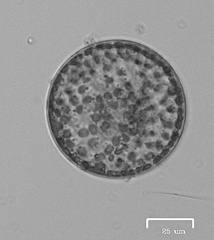 Coscinodiscophycidae