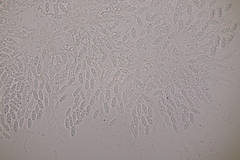 Lasionectria lecanodes