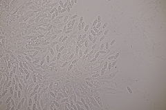 Lasionectria lecanodes