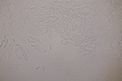 Lasionectria lecanodes