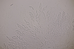 Lasionectria lecanodes