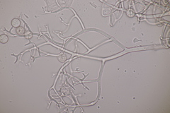 Hyaloperonospora praecox