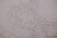 Hyaloperonospora praecox