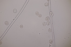 Hyaloperonospora praecox