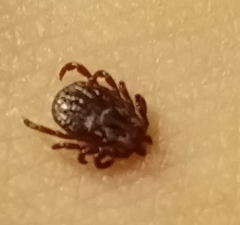 Dermacentor reticulatus