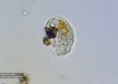 Amoebozoa