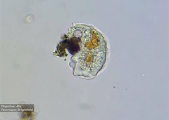 Amoebozoa