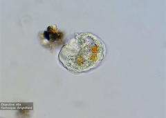 Amoebozoa
