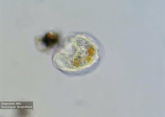 Amoebozoa