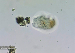 Amoebozoa