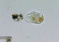 Amoebozoa
