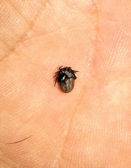 Ixodidae
