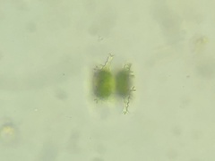 Staurastrum vestitum