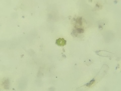 Euastrum denticulatum