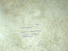 Sowerbyella radiculata