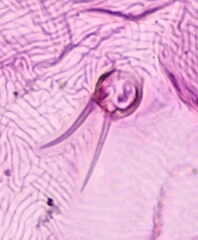 Lepidosaphes newsteadi