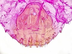 Lepidosaphes newsteadi