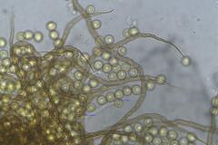Trichia botrytis