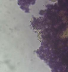 Trichia botrytis