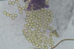 Trichia botrytis