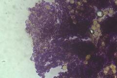 Trichia botrytis